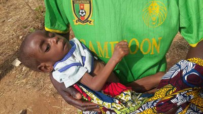 ACNUR aborda situação de saúde alarmante dos refugiados no Camarões